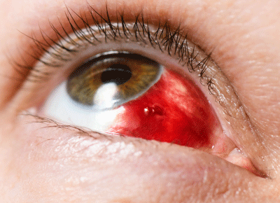 Ocular Trauma and Emergencies